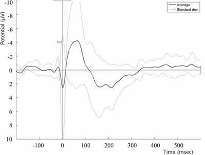 Interhemispheric and Intrahemispheric Connectivity From the Left Pars Opercularis Within the Language Network Is Modulated by Transcranial Stimulation in Healthy Subjects